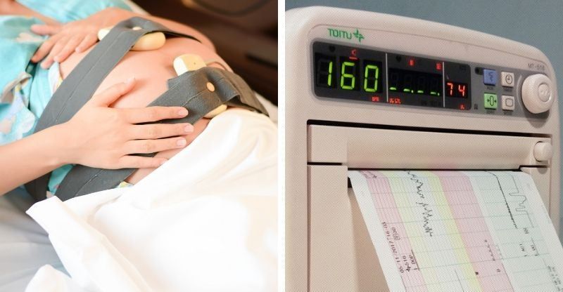 Εξέταση καρδιοτοκογραφήματος NST